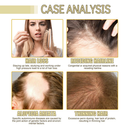 Rosemary Hair Oil Scalp Nourishing Repair Essence