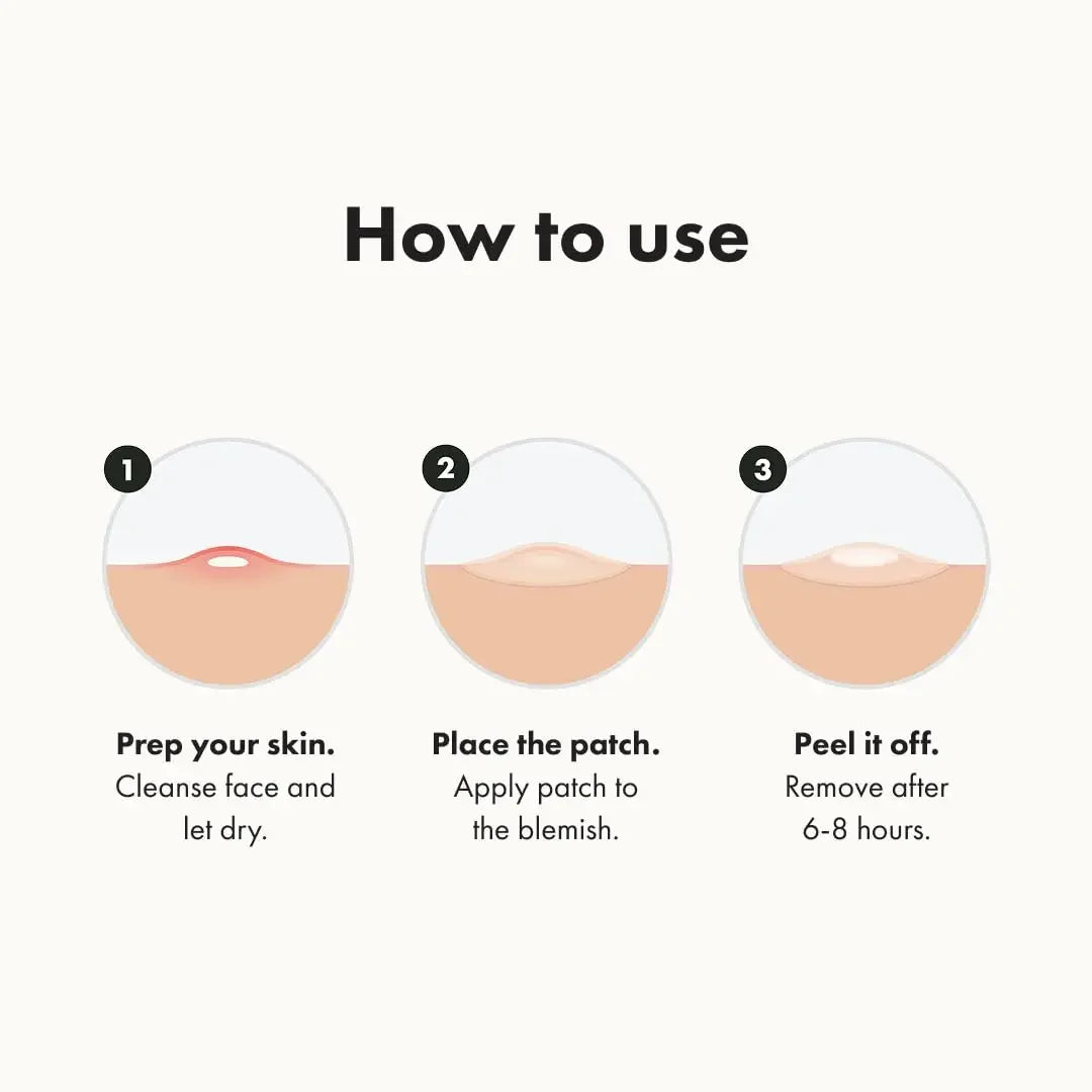 Hero Cosmetics Mighty Patch Hydrocolloid Acne Spot Treatment